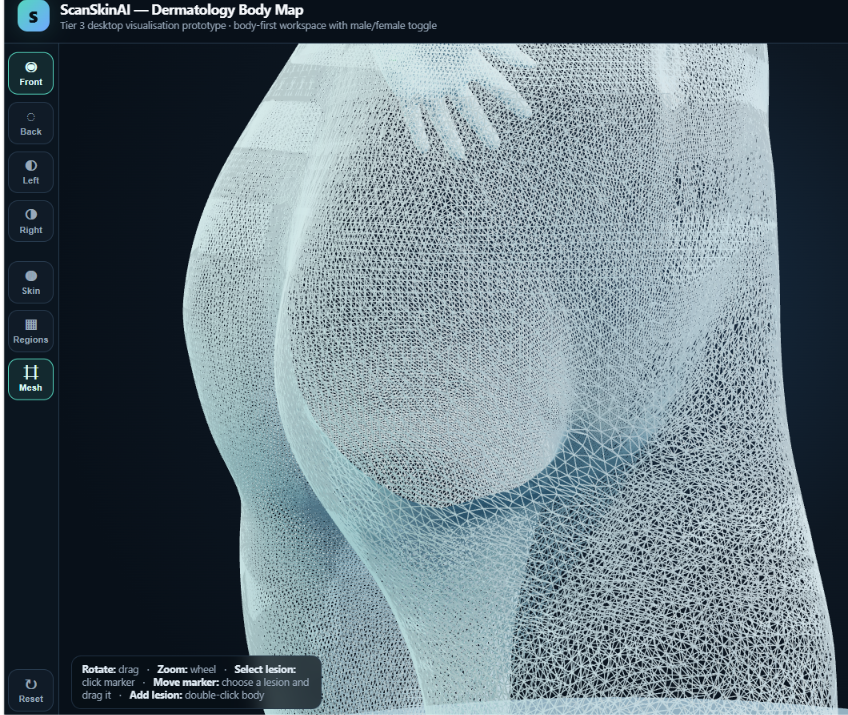 ScanSkinAI Dermatology 3D Body Map — interactive wireframe mesh of the human body with Front, Back, Left, Right, Skin, Regions and Mesh view toggles for plotting moles, lesions and skin findings.