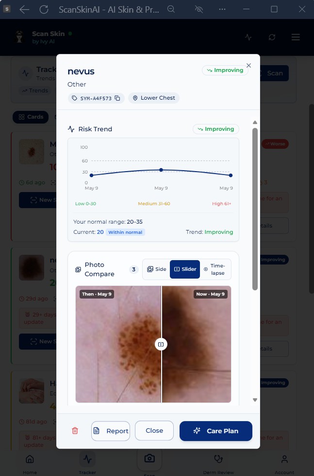 Single mole timeline in ScanSkinAI showing risk trend chart and side-by-side then-and-now photo comparison for a tracked nevus
