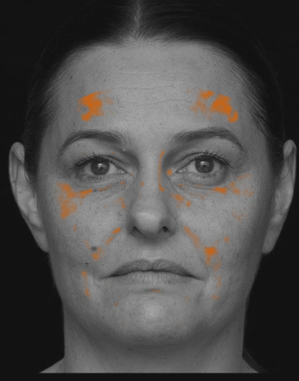 Grayscale facial analysis with orange highlights marking visible brown spots and pigmentation patterns
