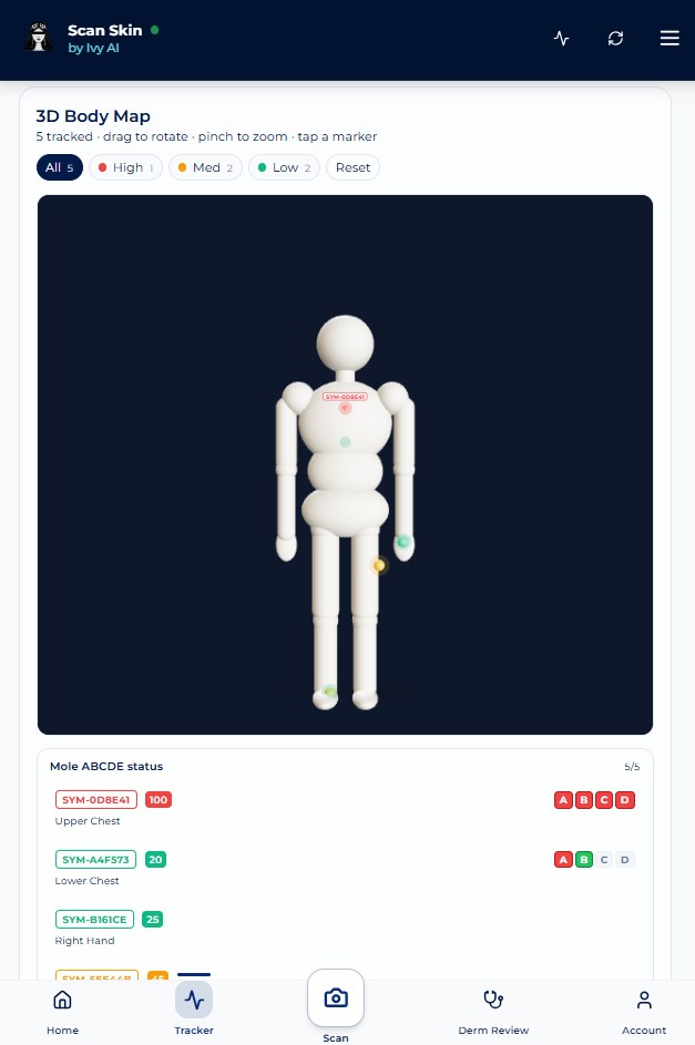 ScanSkinAI 3D body mole map showing five tracked moles colour-coded by risk on a rotatable full-body avatar