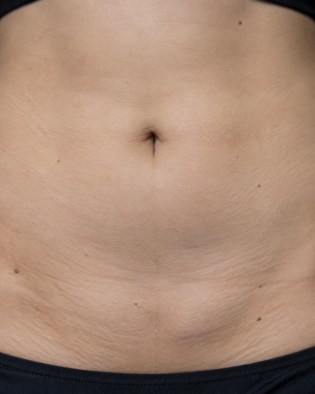 Close-up abdomen assessment detail