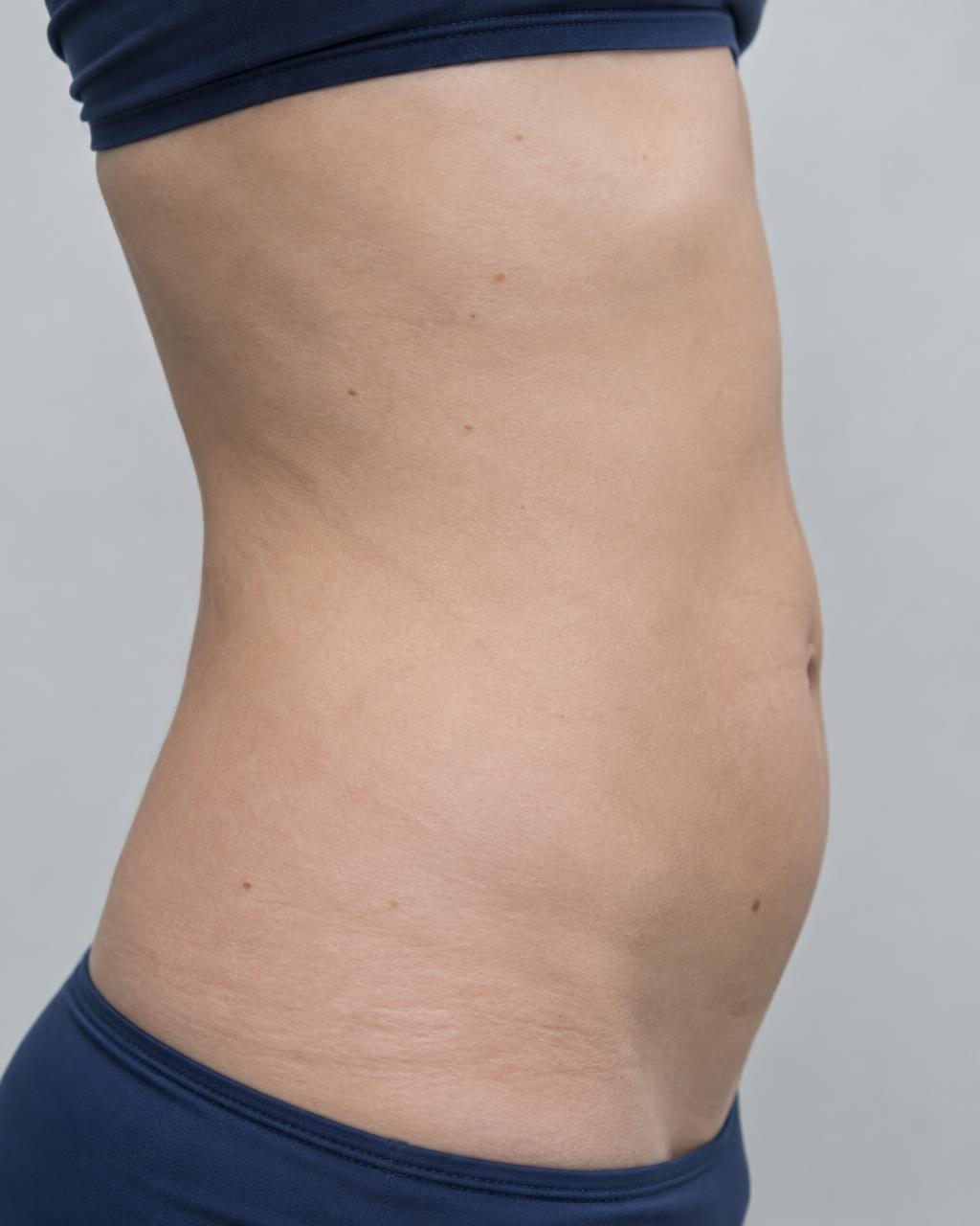 Side-view abdomen assessment