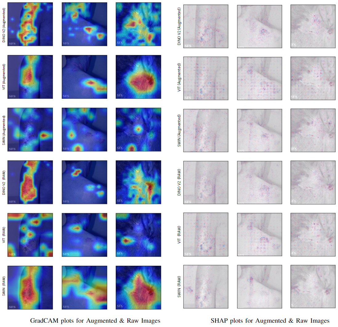 GradCAM and SHAP plots showing heatmap visualizations for augmented and raw skin disease images, demonstrating model interpretability and feature attribution